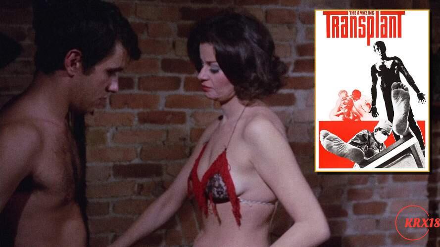 The Amazing Transplant